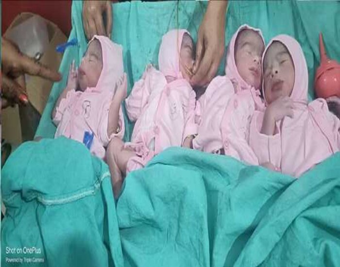 महिला ने एक साथ 4 बच्चे को दिया जन्म.