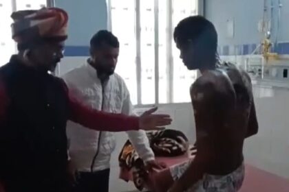 झोपड़ी में आग का तांडव, दो किशोर झुलसे, लाखों की संपत्ति स्वाहा