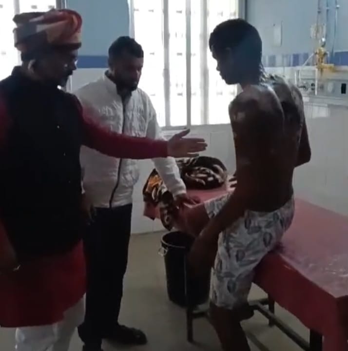 झोपड़ी में आग का तांडव, दो किशोर झुलसे, लाखों की संपत्ति स्वाहा
