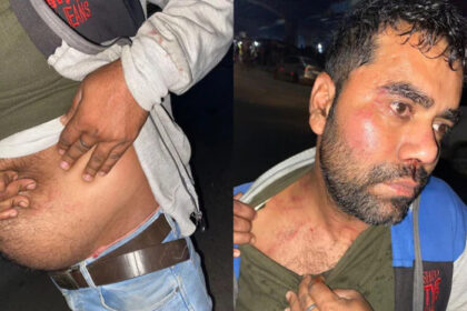 पटना में खाकी की गुंडागर्दी, ट्रैफिक दारोगा ने NMCH डॉक्टर को पीटा…