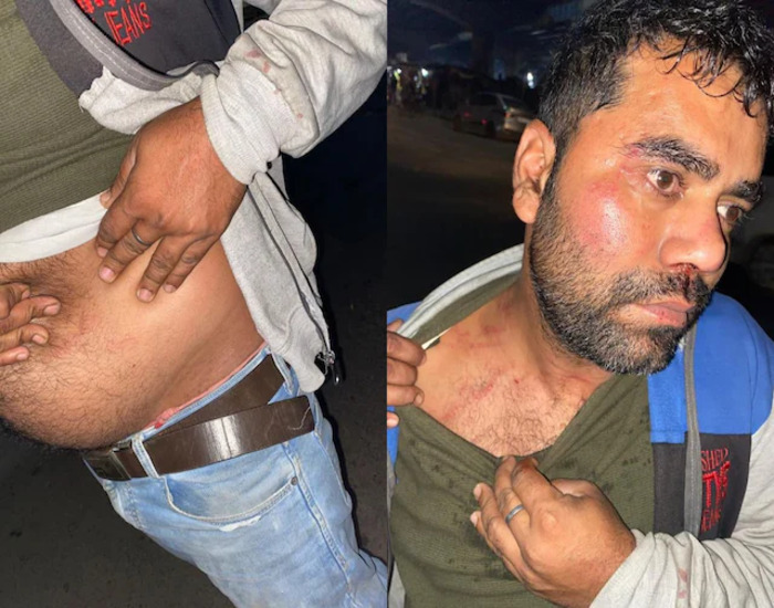 पटना में खाकी की गुंडागर्दी, ट्रैफिक दारोगा ने NMCH डॉक्टर को पीटा…